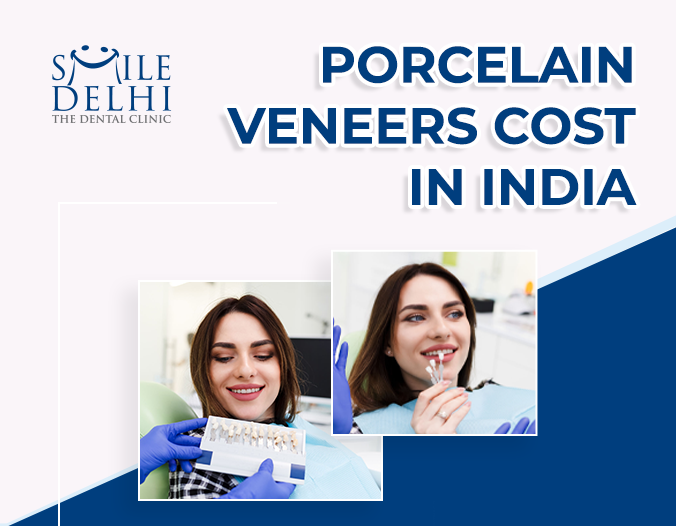 Porcelain-Veneers-Cost-In-India
