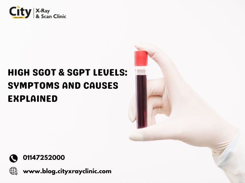 High-SGOT-SGPT-Levels-Symptoms-and-Causes-Explained