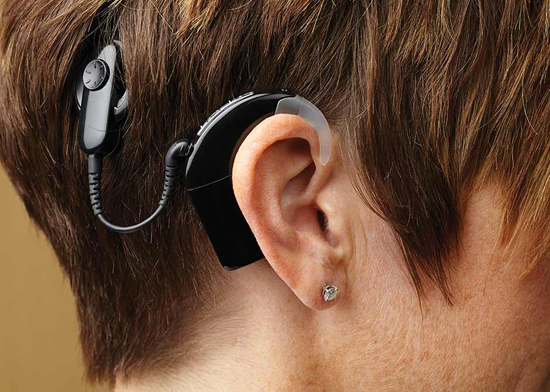 Hearing Device & Digital Hearing Aid Price in Pakistan Today