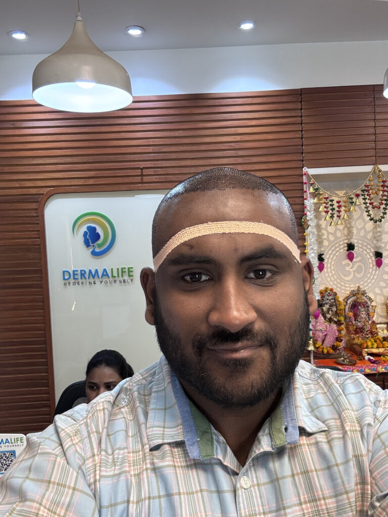 Dermalife – Best Dermatology | Hair Transplant Clinic in Delhi